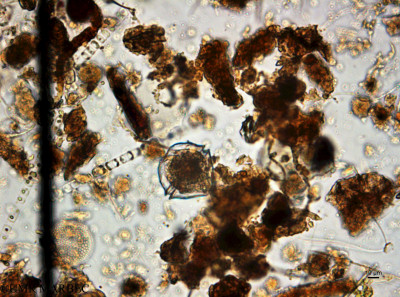 phyto/Guinea golf/Wouri_estuary_Mokushu/YNkouefuthNfongmo_these 2022-2023/Peridiniales 1 (Dino -Moukoucho_SURF_2023_dino_proto230613_001_ovl-2).tif(copy)_thumb.jpg